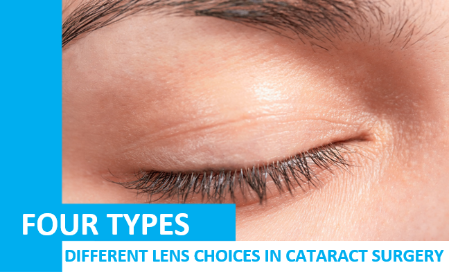 Different Lens Choices in Cataract Surgery